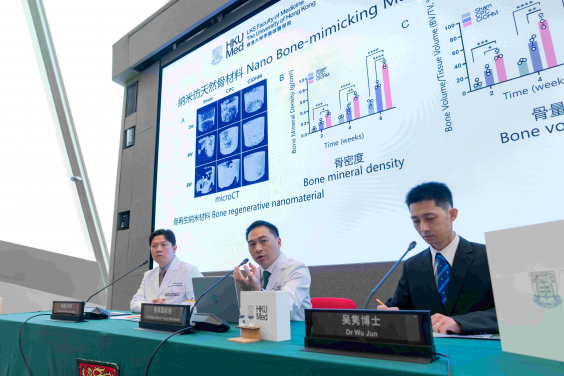A novel elastic calcium phosphate material developed by HKUMed researchers, offers a promising alternative to traditional bone grafts in orthopaedic surgeries. The research team members include (from left) Professor Wong Tak-man, Professor Kelvin Yeung Wai-kwok and Dr Wu Jun.
 